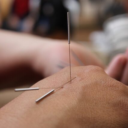 acupuncture-6324472_640.jpg